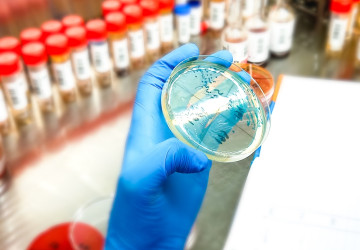 Nebezpečné bakterie se mohou ve vhodných podmínkách šířit velmi rychle. 